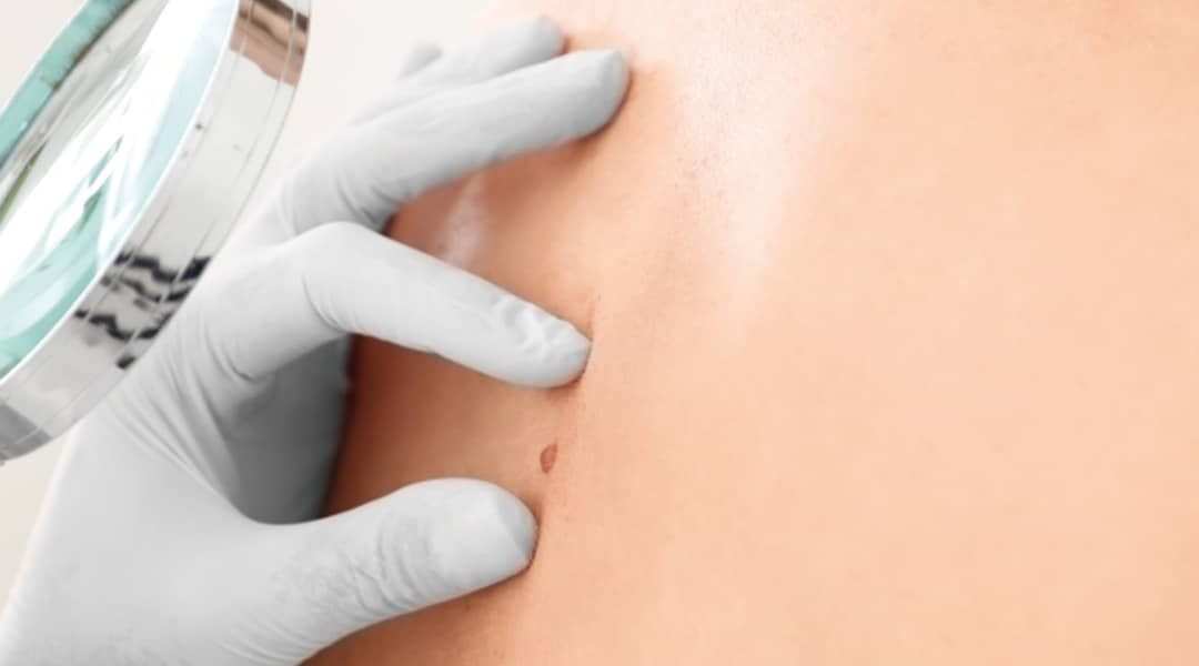 Dermatologie