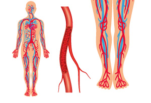 Médecine Vasculaire et Phlébologie