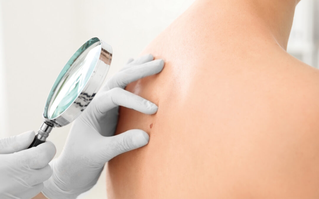 Dermatologie